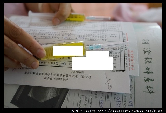 【台北羊膜穿刺】柯滄銘婦產科診所|羊膜穿剌不用5分鐘