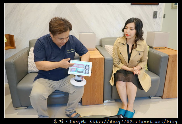 【新竹牙齒美白貼片推薦】陶瓷美白薄片 齒型雕塑 新竹日光翡麗牙醫診所 牙齒美白貼片實例發表會