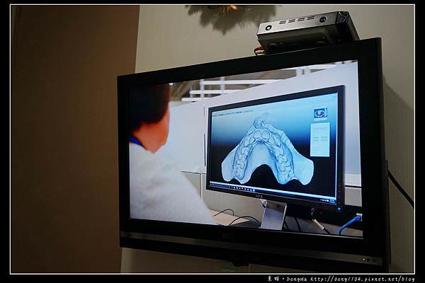 【彰化牙齒矯正推薦】Invisalign 隱適美隱形牙套 陳長泰牙醫診所