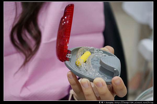 【彰化牙齒矯正推薦】Invisalign 隱適美隱形牙套 陳長泰牙醫診所