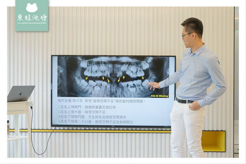 【台中隱適美推薦】南屯區牙齒矯正 青少年暴牙/牙齒不齊好選擇 雅緹斯牙醫診所 Artist Dental Clinic