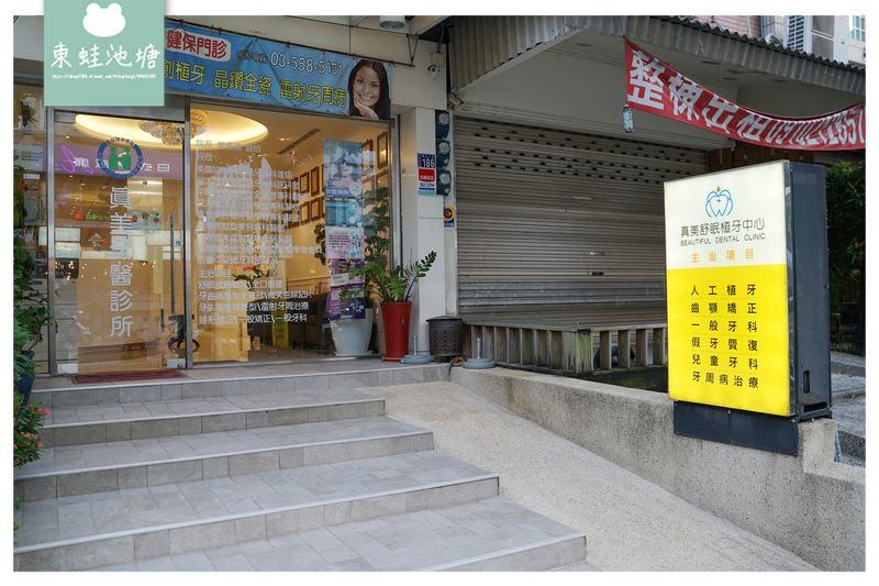 【竹北全瓷冠貼片推薦】全瓷牙冠術前評估 取模咬蠟流程介紹 竹北真美牙醫診所