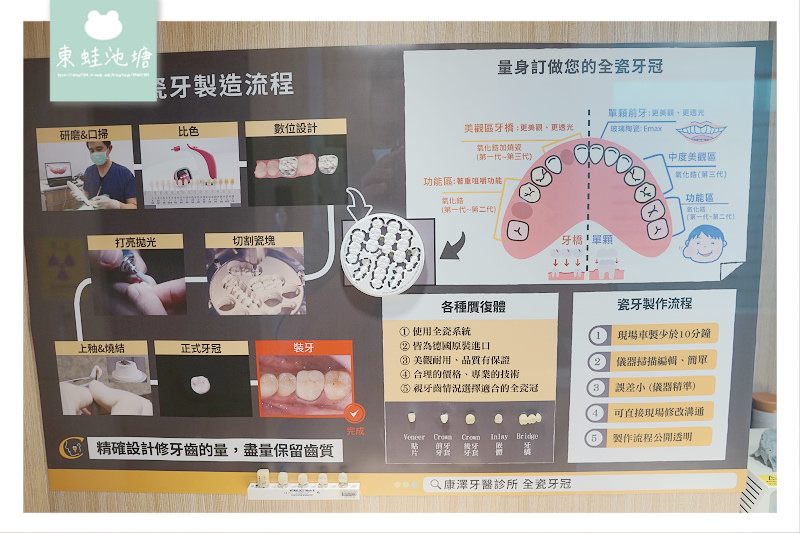 【隱適美隱形矯正心得分享】歷時10個月的牙齒矯正過程 林口康澤牙醫診所