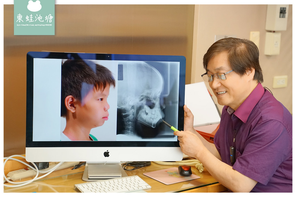 【台中隱形矯正推薦】齒顎矯正專科醫師 隱適美隱形矯正專家 上誠齒顎矯正中心