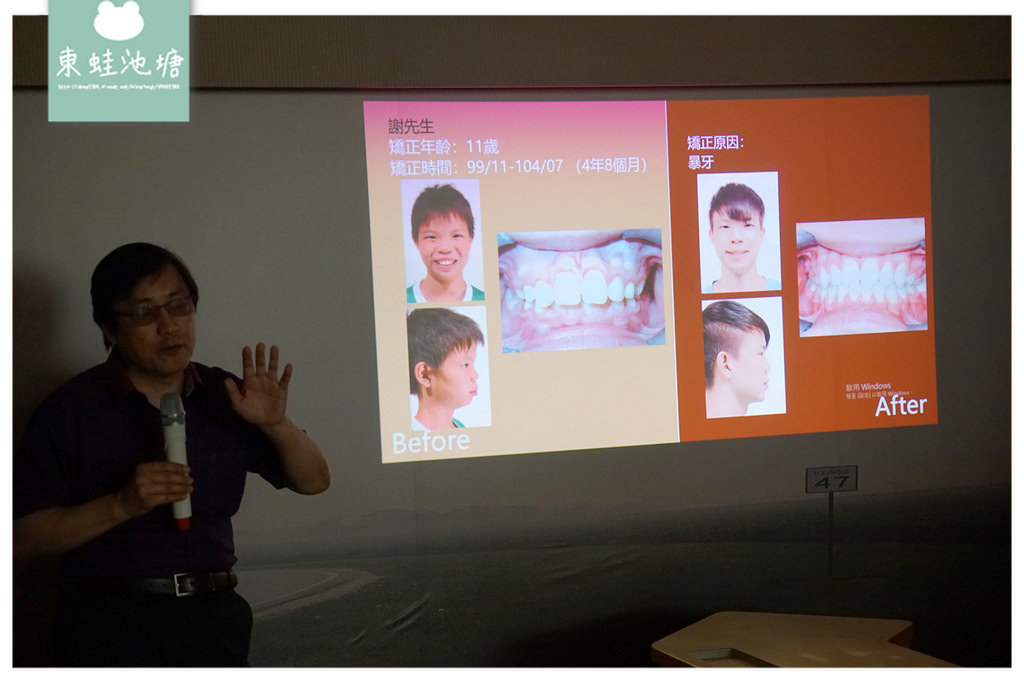 【台中隱形矯正推薦】齒顎矯正專科醫師 隱適美隱形矯正專家 上誠齒顎矯正中心