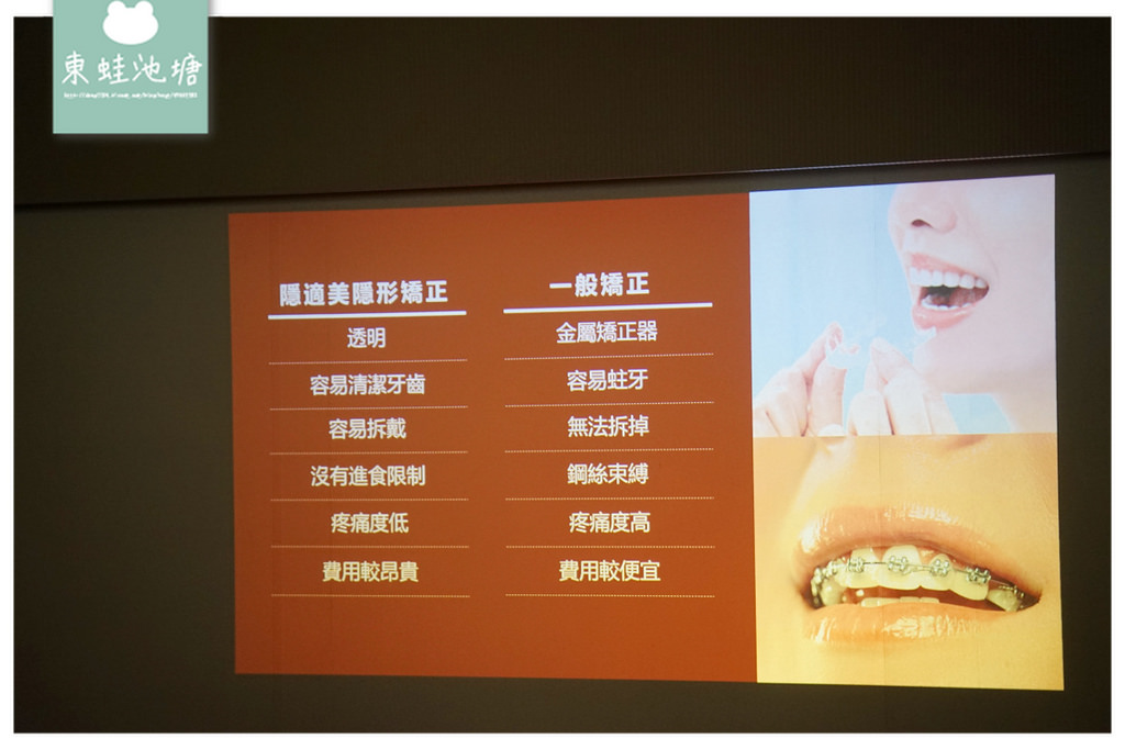【台中隱形矯正推薦】齒顎矯正專科醫師 隱適美隱形矯正專家 上誠齒顎矯正中心