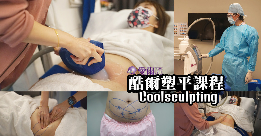 【愛爾麗醫美診所】Coolsculpting 酷爾塑平課程 無痛非侵入 療程時間更短
